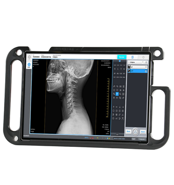 Portable display for a digital radiography system